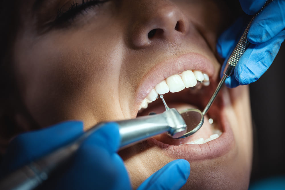 limpieza dental