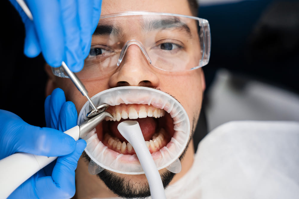 limpieza dental