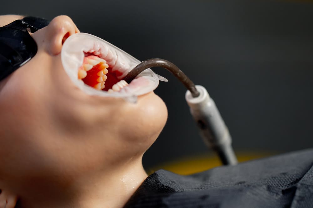 limpieza dental