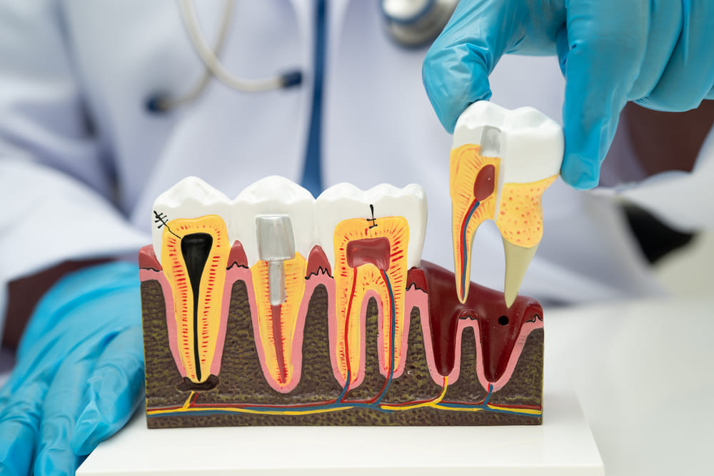 pulpa dental