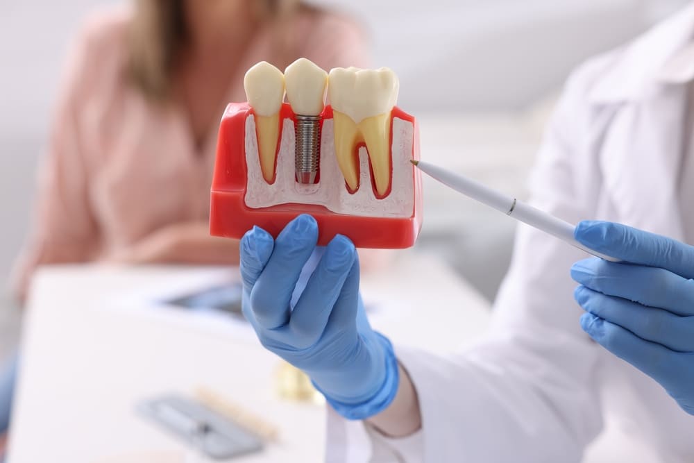 Endodoncia en Panamá: todo lo que se debe saber sobre este tratamiento