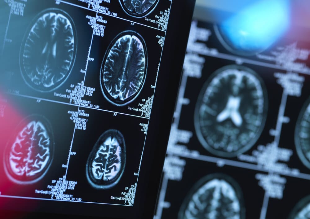 Neuro Leaders Forum en Guatemala: un espacio para compartir conocimientos especializados
