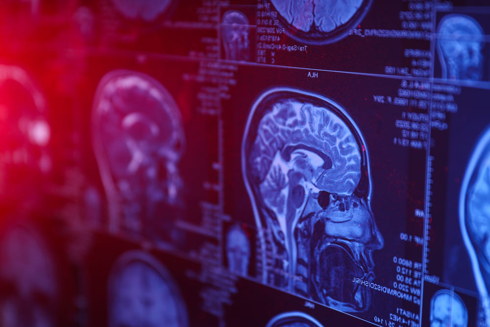 Hospital El Pilar fomenta la colaboración internacional en neurocirugía durante el Neuro Leaders Forum