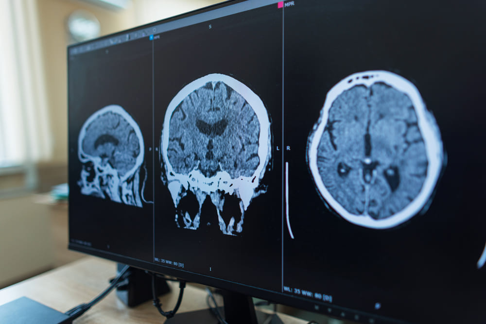 Hospital El Pilar promueve avances en neurocirugía con el Neuro Leaders Forum en Guatemala