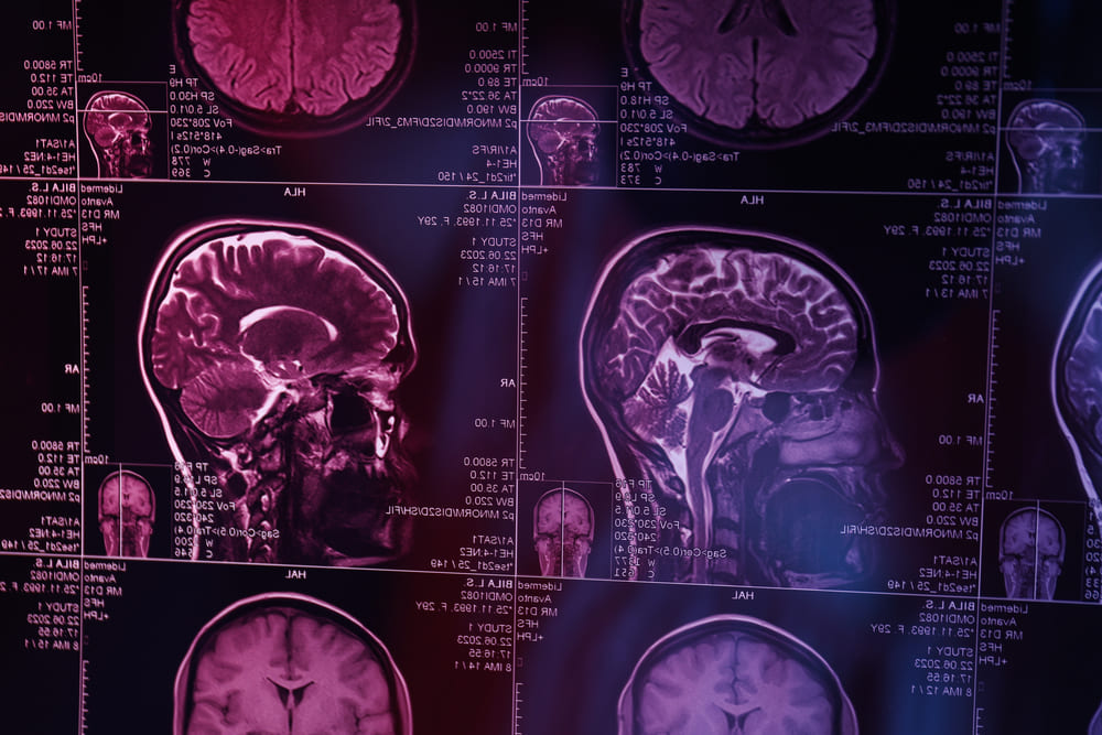Neuro Leaders Forum en Guatemala: tecnología y experiencia clínica en neurocirugía