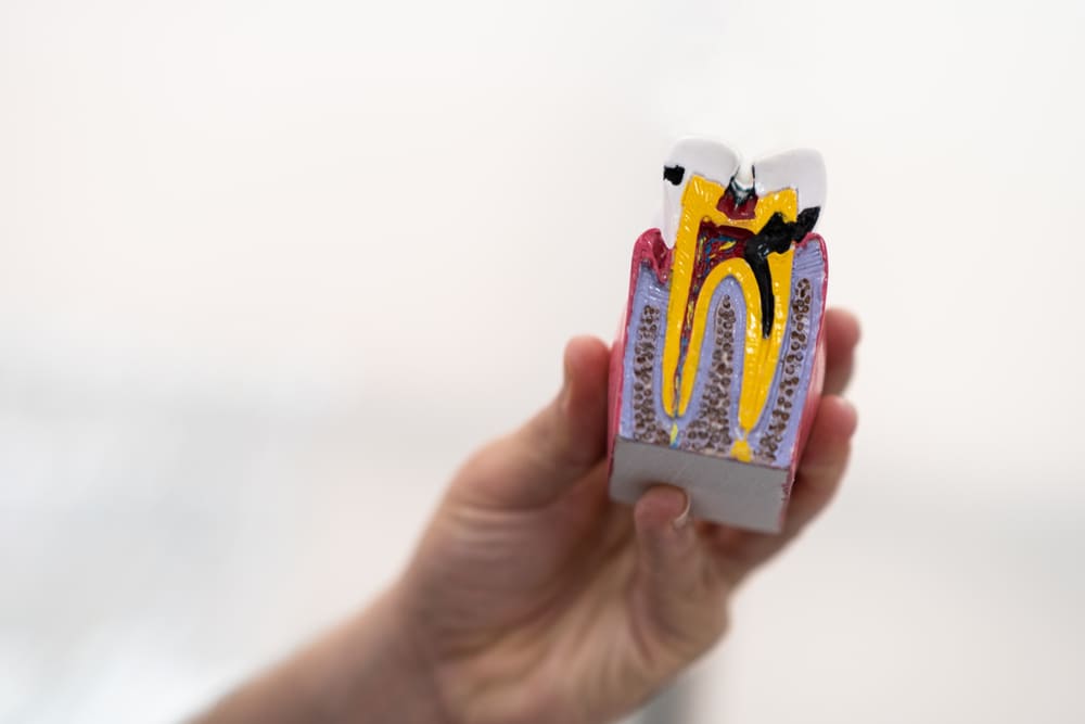 La importancia de la periodoncia en Panamá para la salud del hueso dental