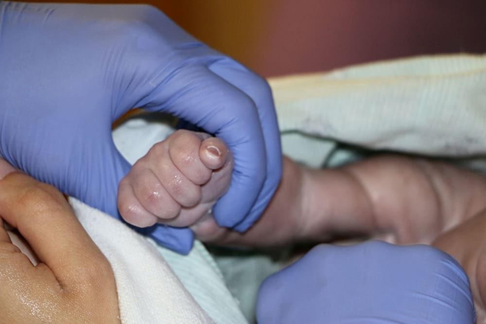 Cómo el tamizaje neonatal en Ciudad de Guatemala ayuda a prevenir complicaciones en recién nacidos